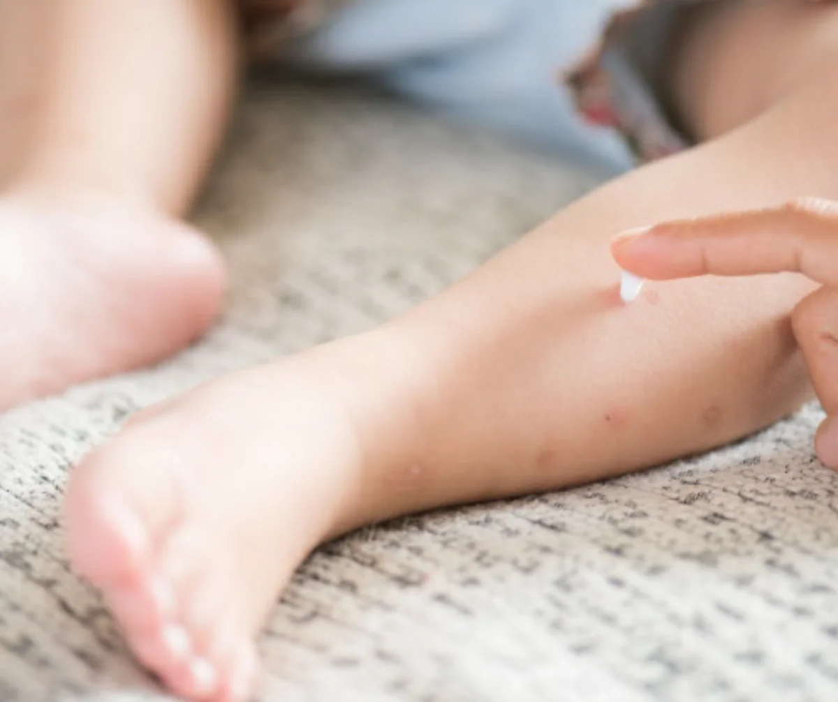 Read more about the article 5 Natural Ways To Get Rid Of Mosquitoes